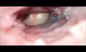 Internal camera records how a cock penetrates a delicious wet ass